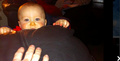 Photo of baby with orange nose carotenoma